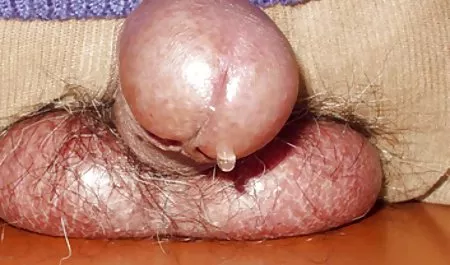 السرطان الجنس صور سكس عربي سوري